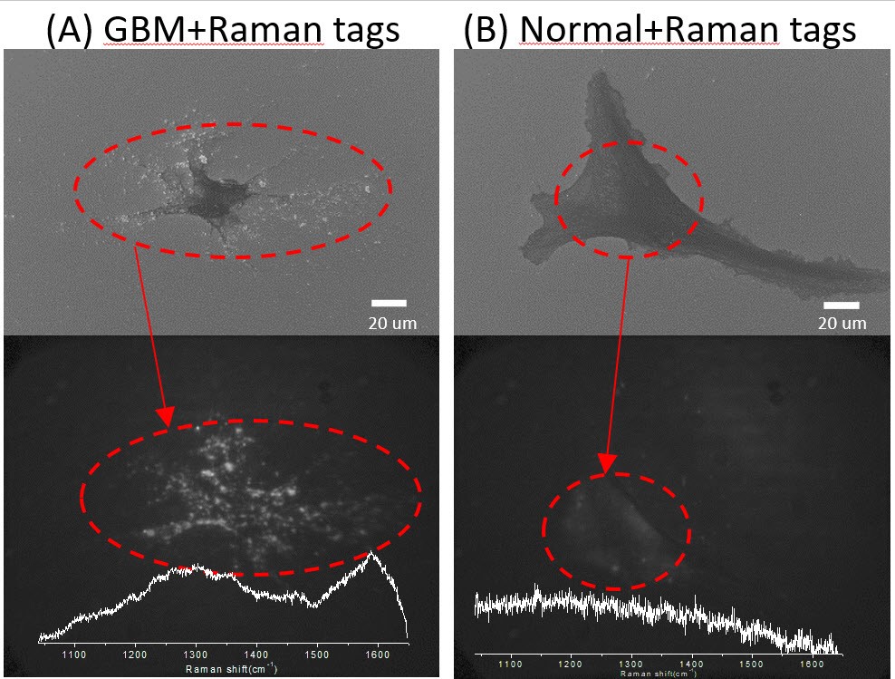 Fig. 3. SEM image, broadband Raman image, and corresponding spectrum of a (A) GBM cell and (B) normal cell [2].