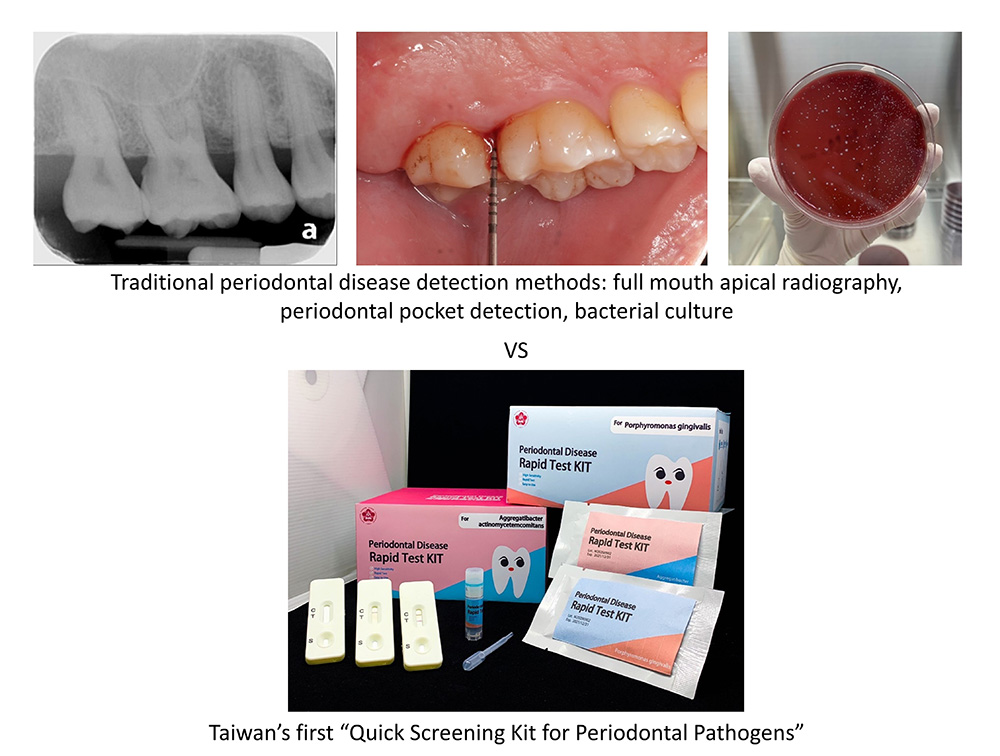 Figure 3. Traditional periodontal disease detection methods vs. Quick Screening Kit for Periodontal Pathogens