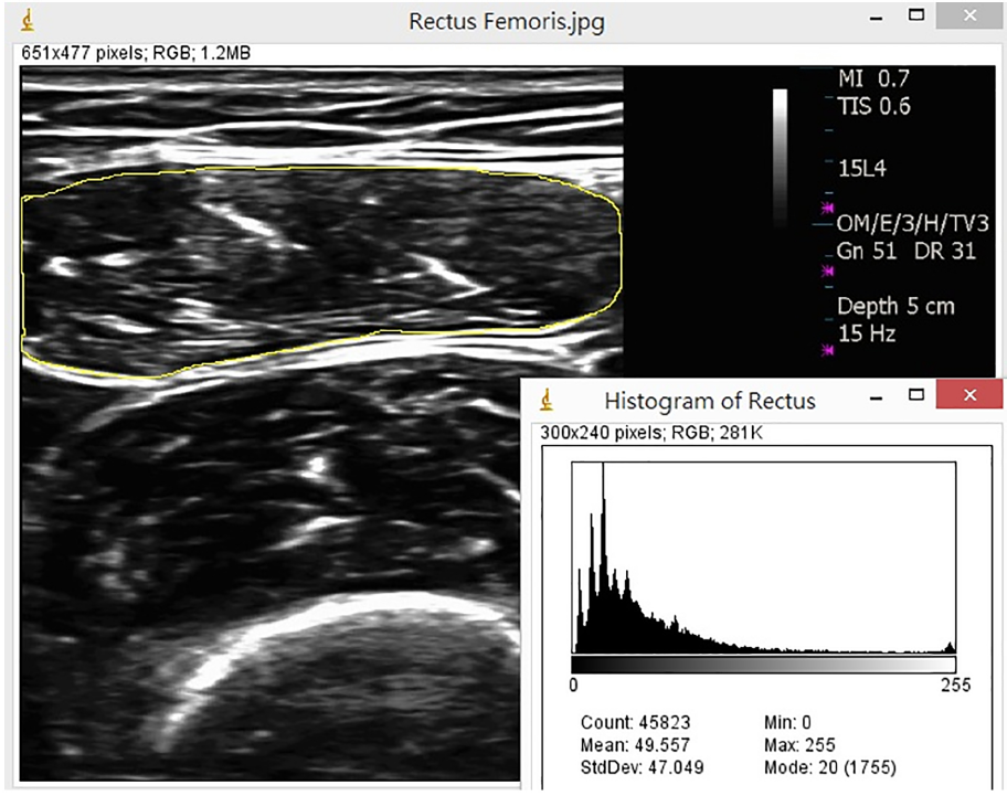 Measurement of muscle mass by ultrasonography