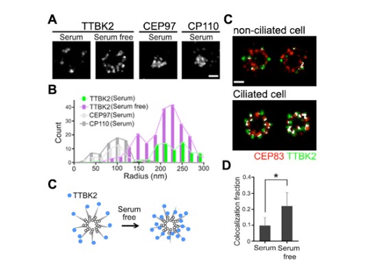 Figure 1: TTBK2 is enriched toward the axoneme, and colocalizes with CEP83 during ciliogenesis.