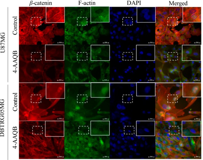 Figure 3. Immunofluorescence Staining Showed 4-AAQB Inhibits a Powerful oncogene, β-catenin in GBM cells