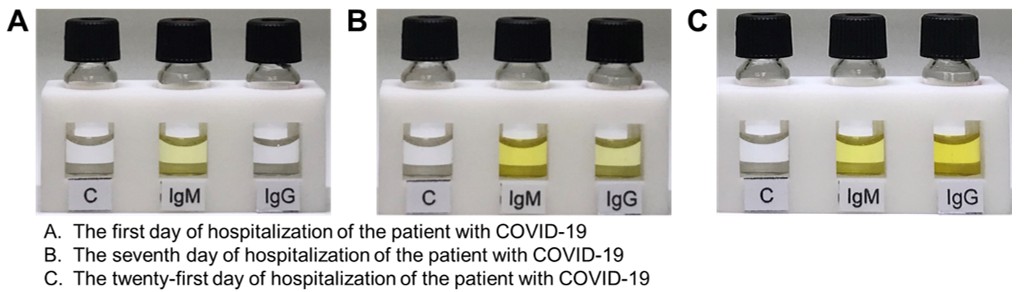 Figure 2. The testing of blood samples from a patient who returned to Taiwan from abroad and showed no obvious symptoms but was tested positive by qRT-PCR. The IgM antibodies can be detected in the blood of the first day of hospitalization and the IgG antibodies can be further detected in the blood of the seventh day and twenty-first day of hospitalization.