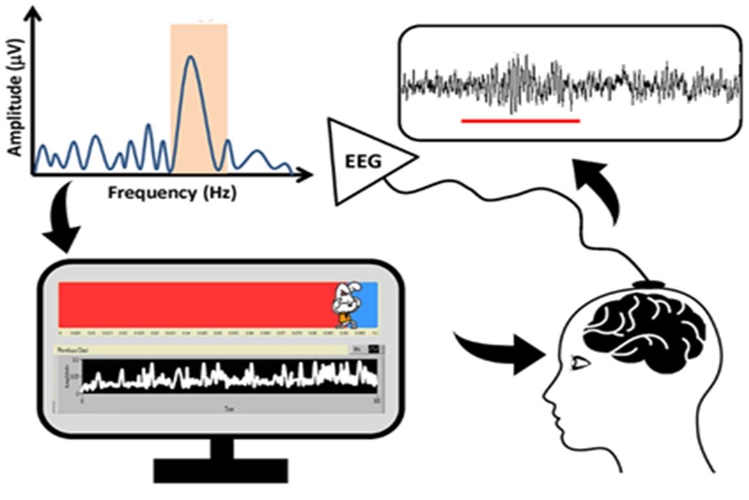 Fig. 1: Diagram of a neurofeedback training system