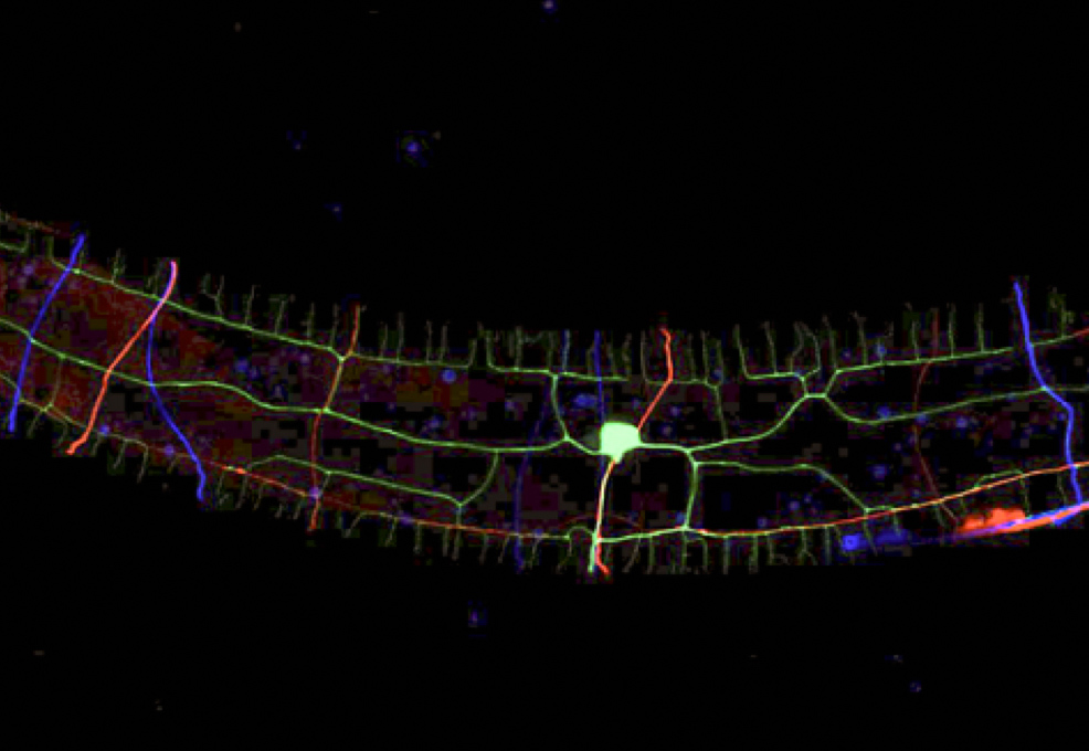 Sculpting A Perfect Neuron