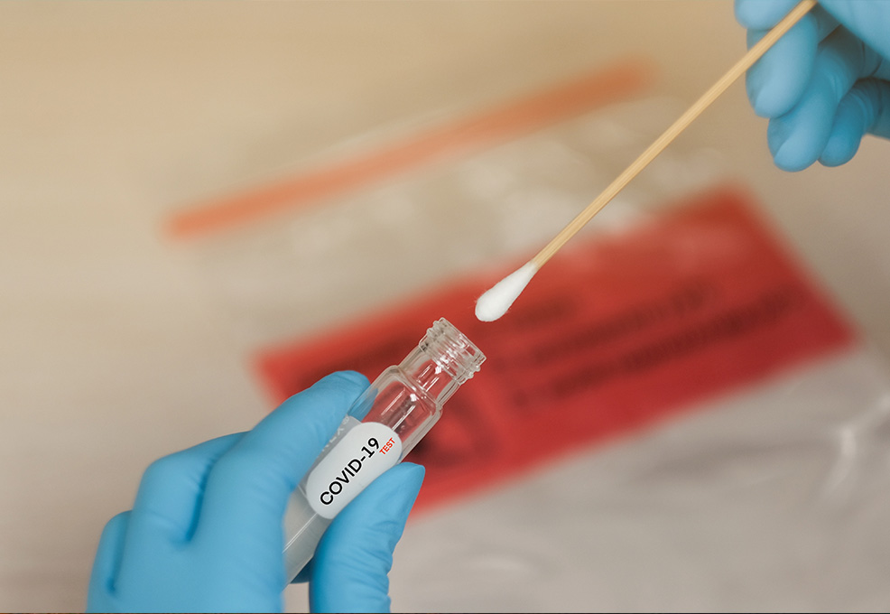 Revealing COVID-19 infection using a Coronavirus protein microarray 